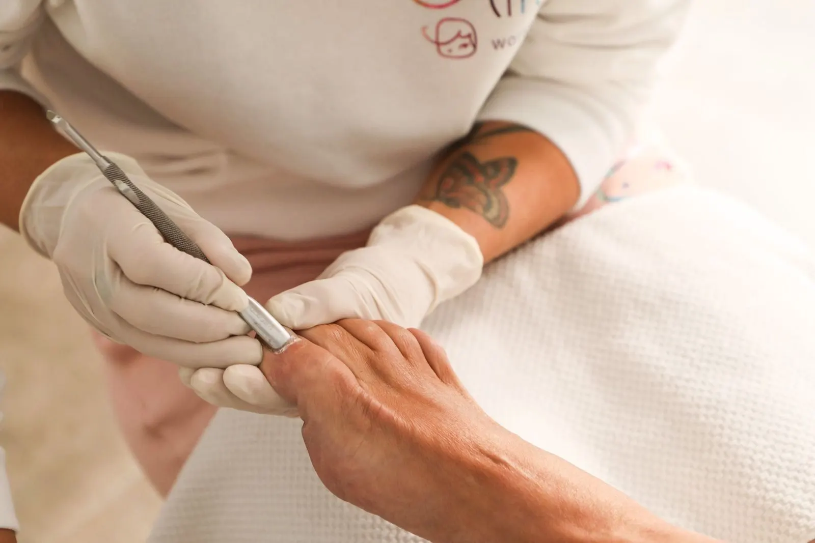 Tratament hiperkeratoză plantară (piele îngroșată pe tălpi) la MediPedi, 1 Decembrie, Ilfov